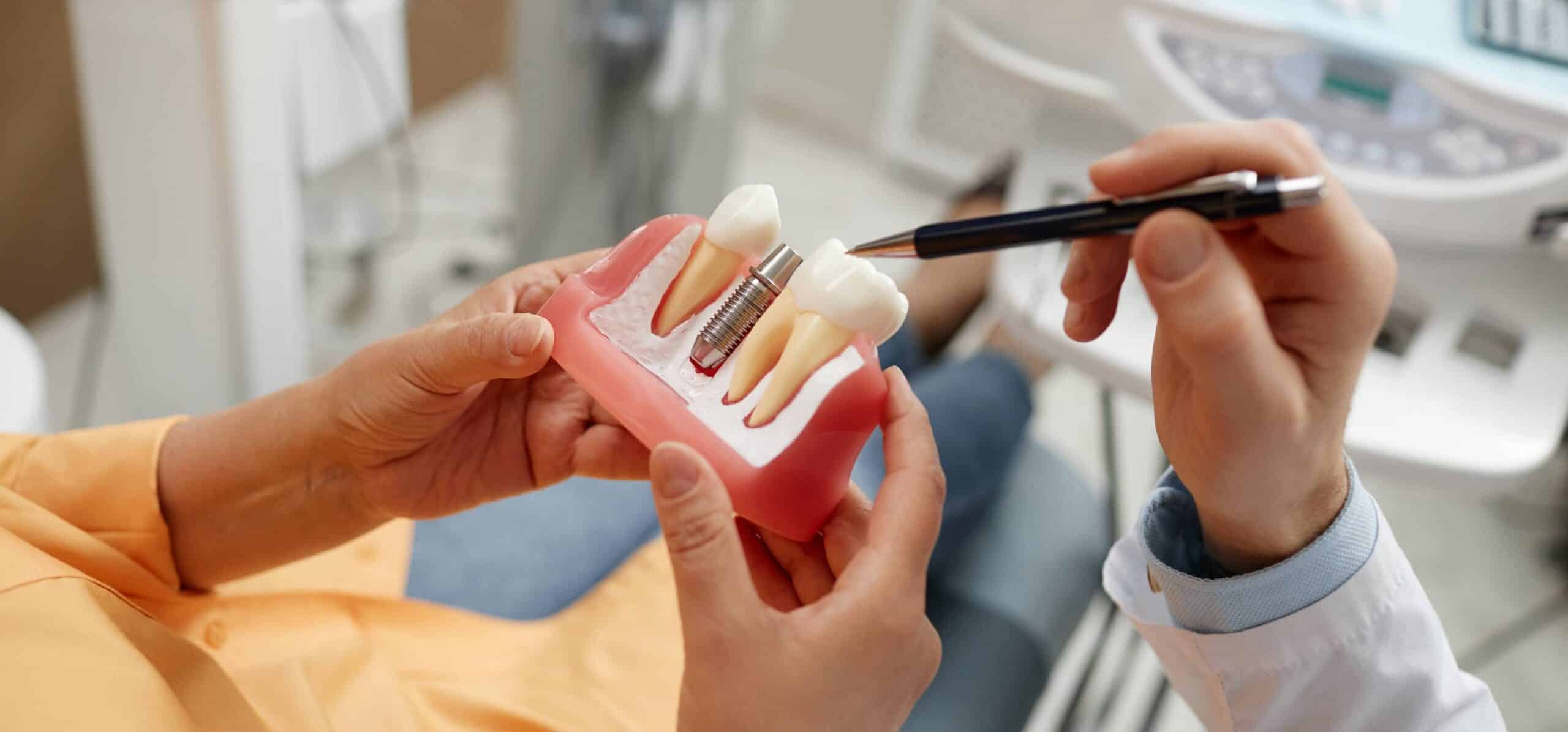 Implantologie dentaire | Dr Temstet | Paris