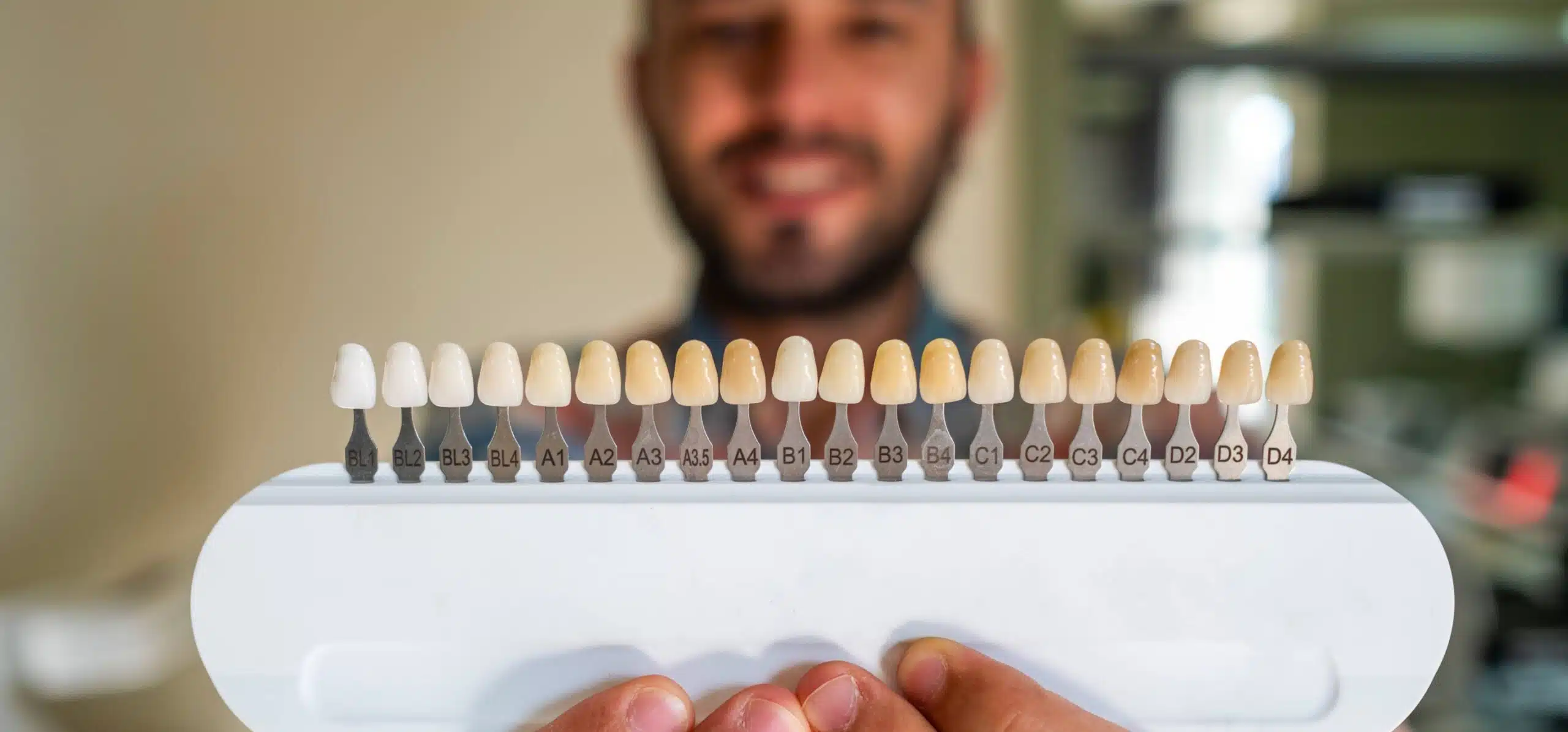 Facettes céramique VS facettes composite | Dr Temstet | Paris