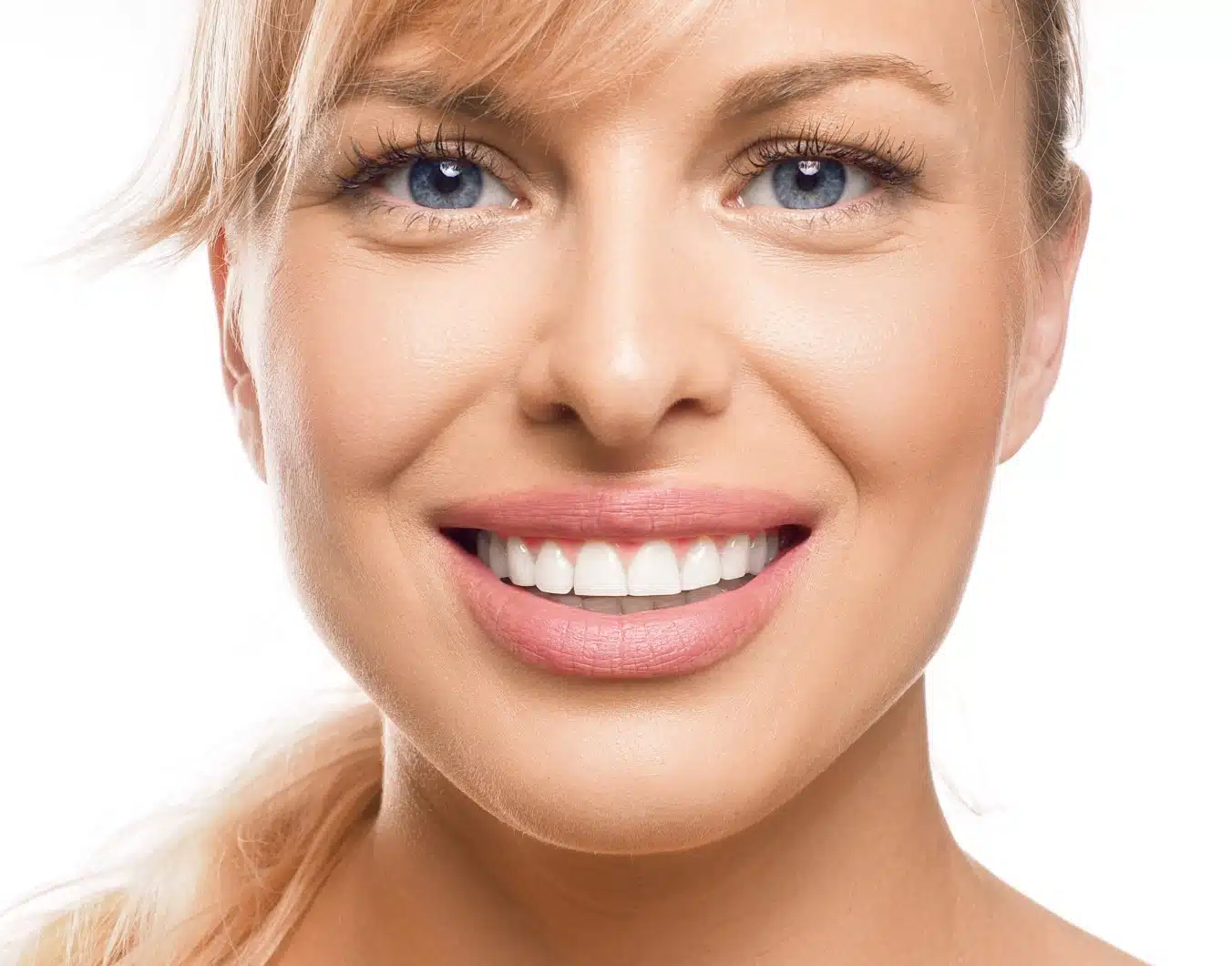 Dr Temstet à Paris vous explique comment agir face à une facette dentaire ratée