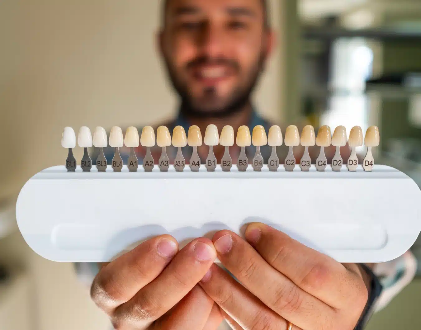 Facettes céramique VS facettes composite | Dr Temstet | Paris