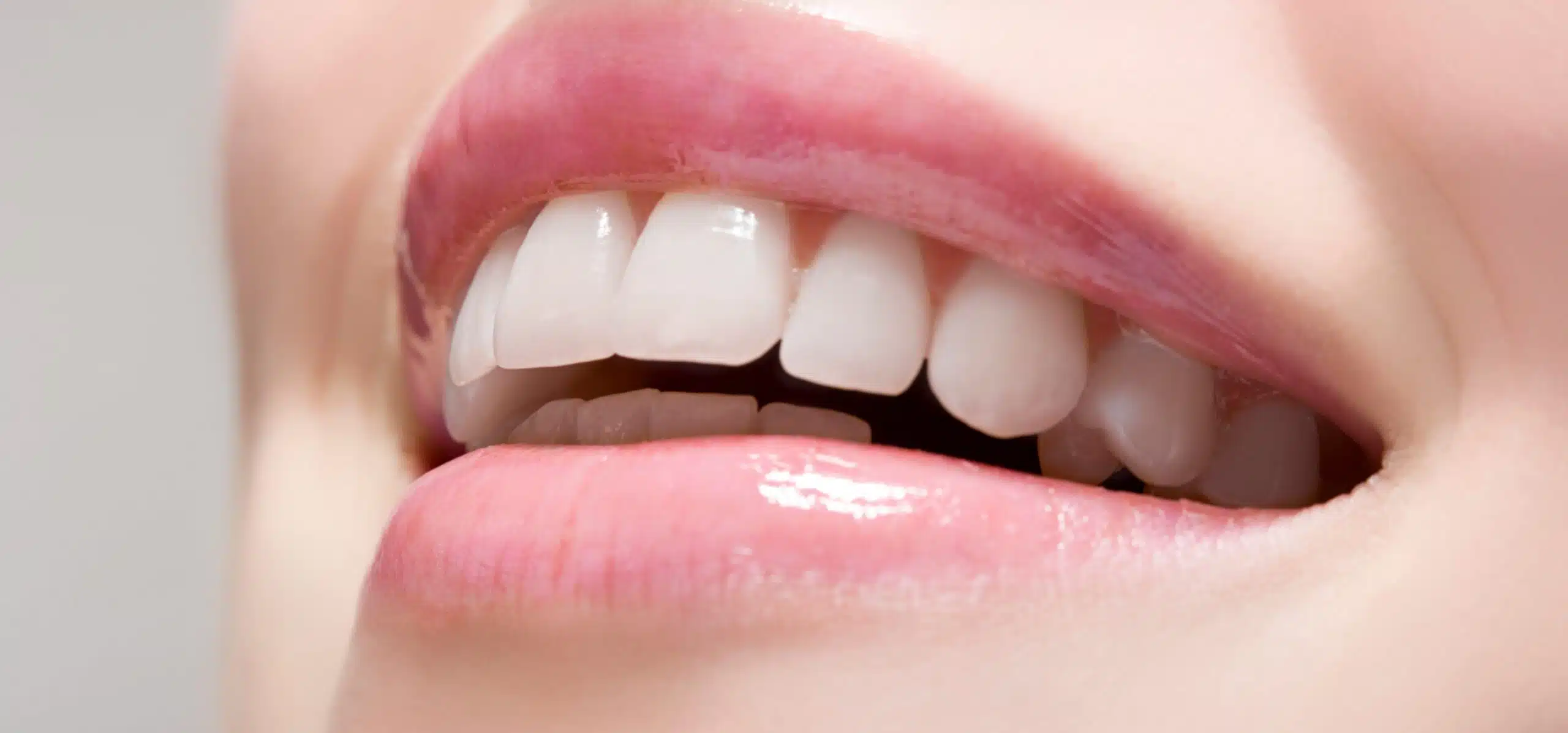 Les différences entre un inlay et un onlay avec le Dr Temstet, dentiste spécialisé à Paris