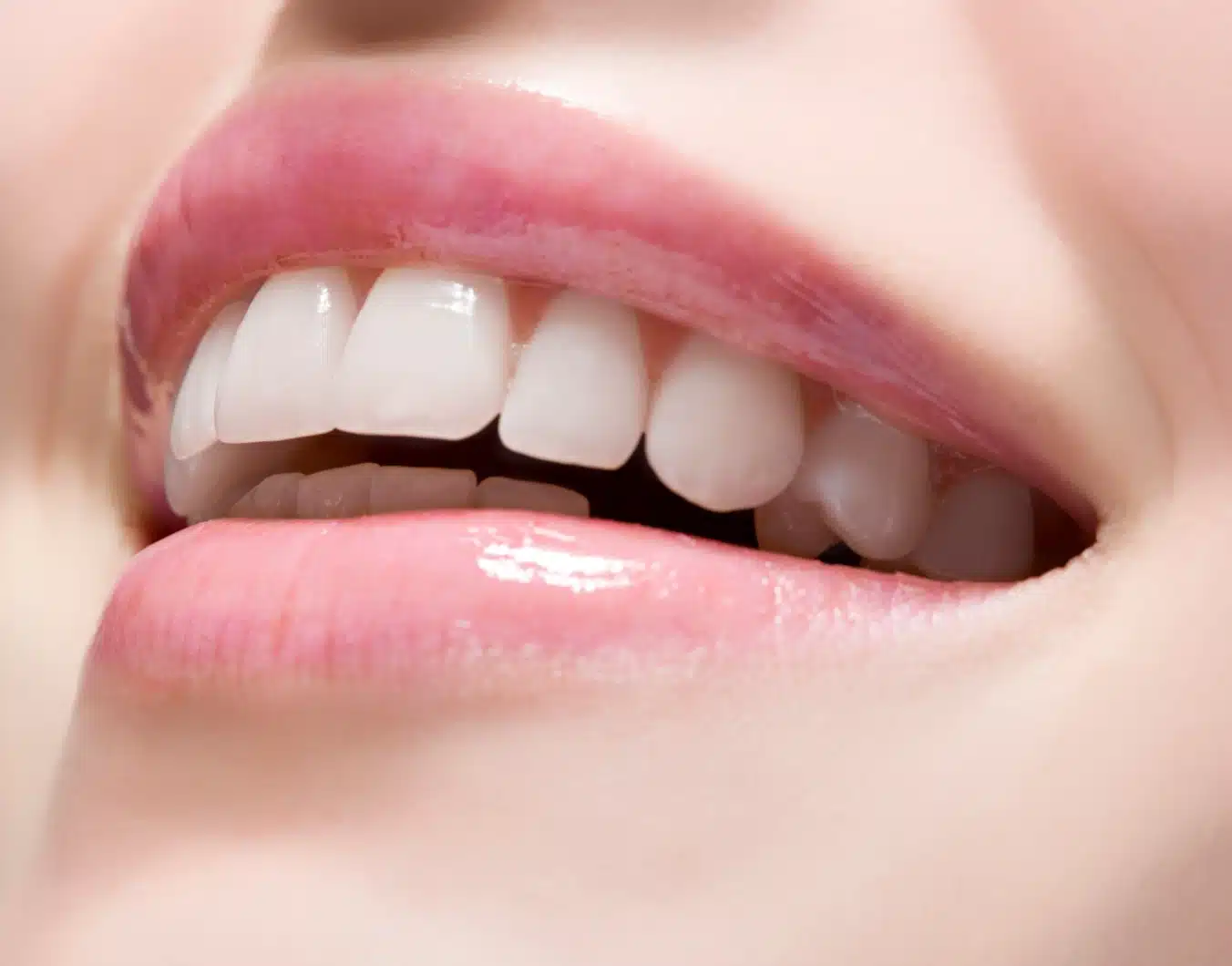 Les différences entre un inlay et un onlay avec le Dr Temstet, dentiste spécialisé à Paris