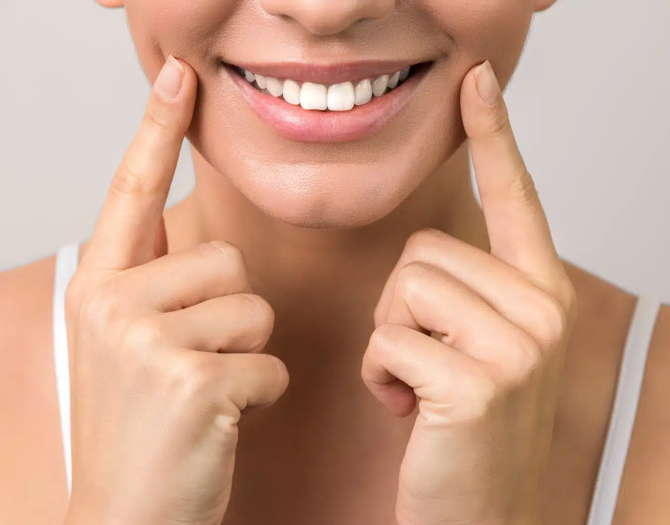 Avis facettes dentaires