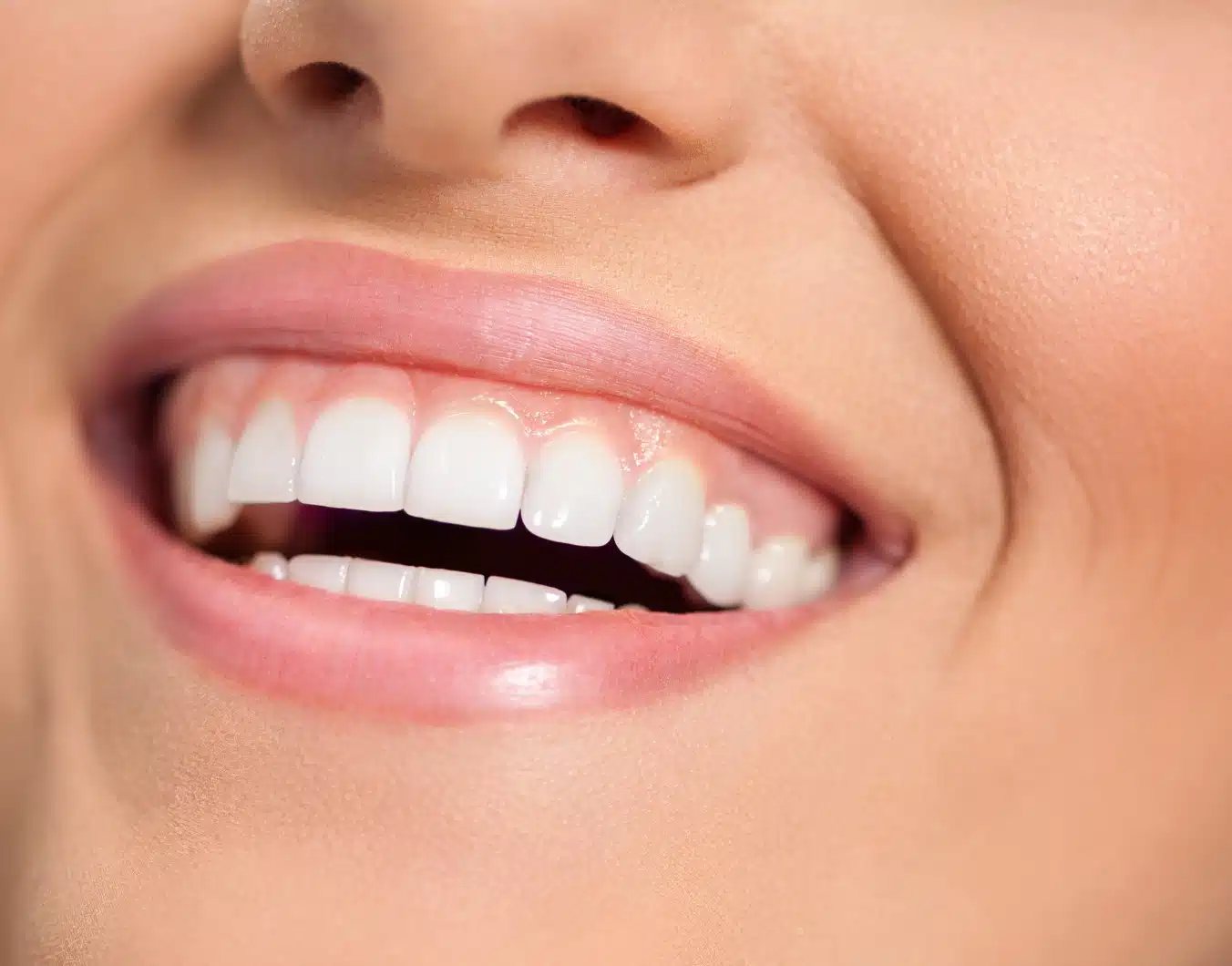 Facettes dentaire abîment dents