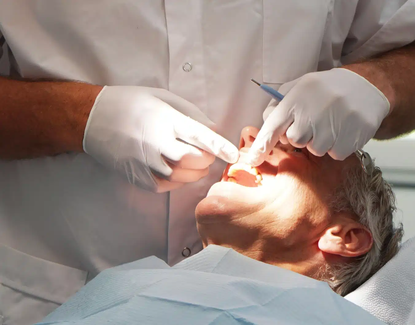 Retrait couronne dentaire