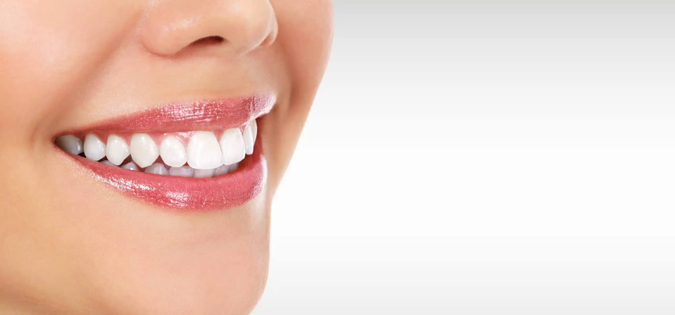 facettes dentaires dangers