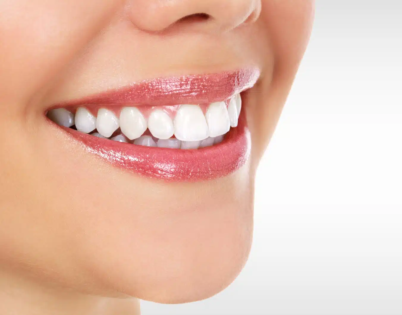 facettes dentaires dangers