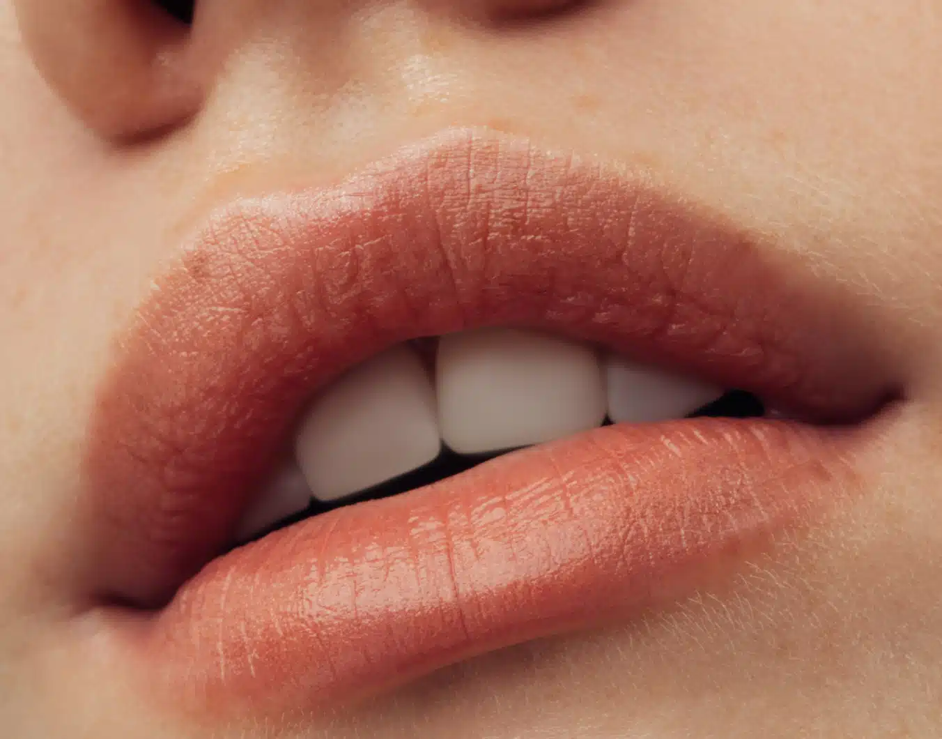 pourquoi céramique artisanale supérieure digital | Dr Temstet | Paris